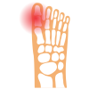 Centre du mouvement - Intervention - Pathologie